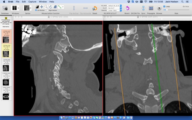 Head and Neck Imaging What the Consultant Radiologist Needs to Know Infomed Online